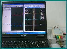 心电图解析系统与工作站 SP2006